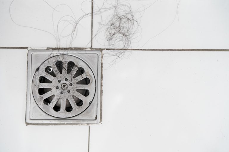 hair loss